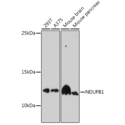 NDUFB1 Rabbit pAb