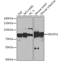 NDUFS1 Rabbit pAb