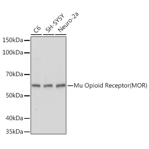 Mu Opioid Receptor(MOR) Rabbit pAb