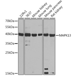 MAPK13 Rabbit pAb