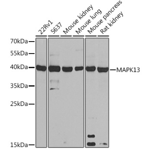 MAPK13 Rabbit pAb