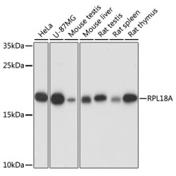 RPL18A Rabbit pAb