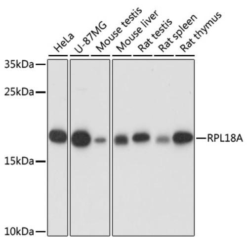 RPL18A Rabbit pAb