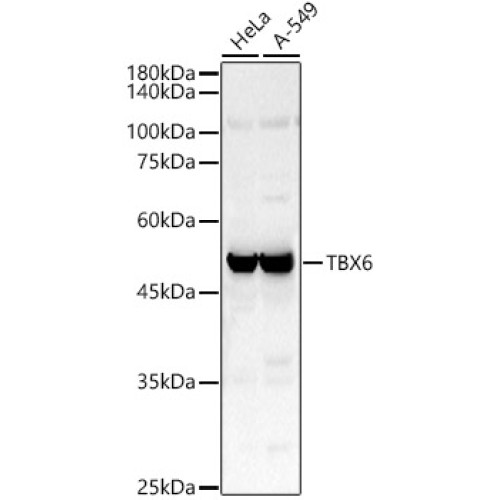 TBX6 Rabbit pAb