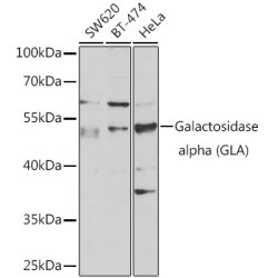 Galactosidase alpha (GLA) Rabbit pAb