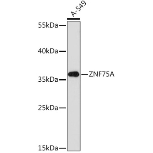 ZNF75A Rabbit pAb