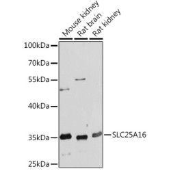 SLC25A16 Rabbit pAb