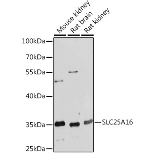 SLC25A16 Rabbit pAb