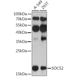 SOCS2 Rabbit pAb