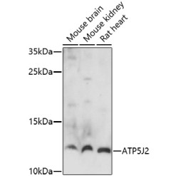 ATP5J2 Rabbit pAb