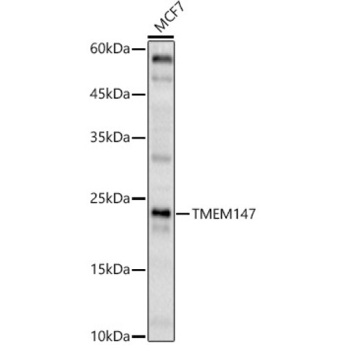 TMEM147 Rabbit pAb
