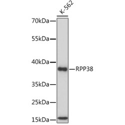 RPP38 Rabbit pAb