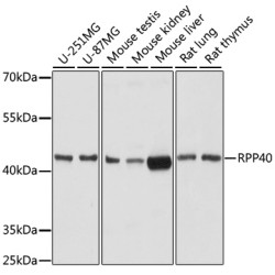 RPP40 Rabbit pAb