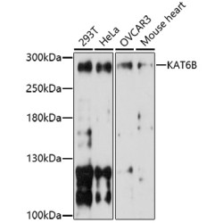 KAT6B Rabbit pAb