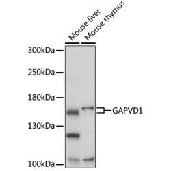 GAPVD1 Rabbit pAb