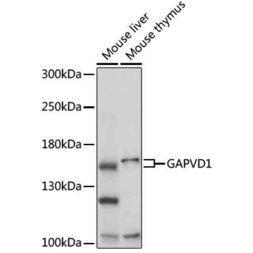 GAPVD1 Rabbit pAb