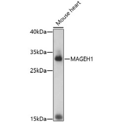 MAGEH1 Rabbit pAb
