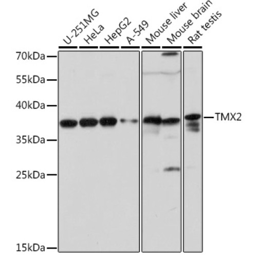 TMX2 Rabbit pAb
