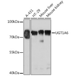 UGT1A6 Rabbit pAb