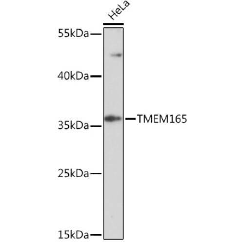 TMEM165 Rabbit pAb