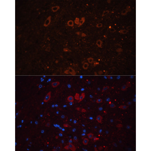 VGLUT1 Rabbit pAb