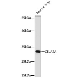 CELA2A Rabbit pAb