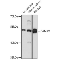 CAMKV Rabbit pAb
