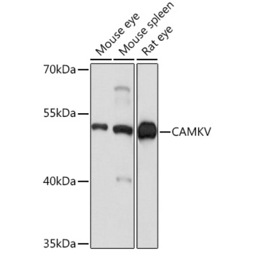 CAMKV Rabbit pAb