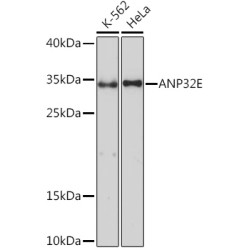 ANP32E Rabbit pAb