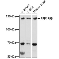 PPP1R9B Rabbit pAb