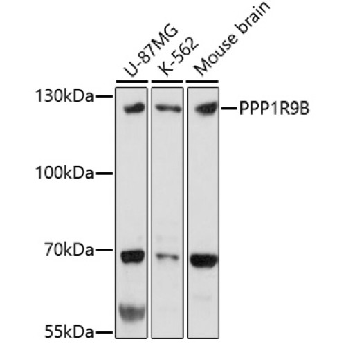 PPP1R9B Rabbit pAb