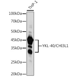 YKL-40/CHI3L1 Rabbit pAb