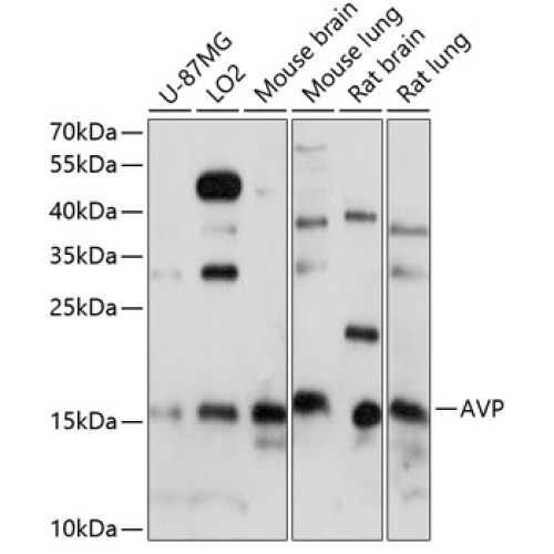 AVP Rabbit pAb