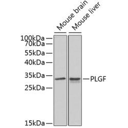 PLGF Rabbit pAb