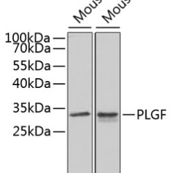 PLGF Rabbit pAb