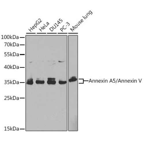 [KO Validated] Annexin A5/Annexin V Rabbit pAb