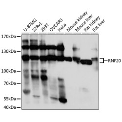 RNF20 Rabbit pAb
