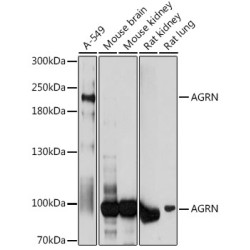 AGRN Rabbit pAb