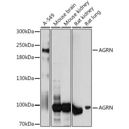AGRN Rabbit pAb