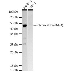 Inhibin alpha (INHA) Rabbit pAb