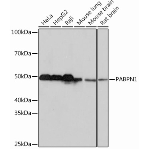 PABPN1 Rabbit mAb