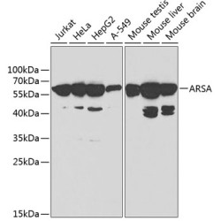 ARSA Rabbit pAb