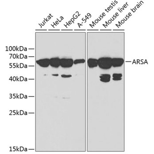 ARSA Rabbit pAb