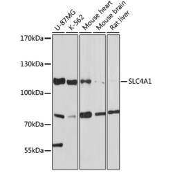 SLC4A1 Rabbit pAb