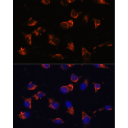 CA19-9 Mouse mAb