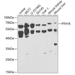 PTH1R Rabbit pAb