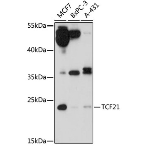 TCF21 Rabbit pAb