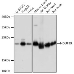 NDUFB9 Rabbit pAb