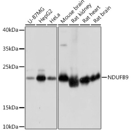 NDUFB9 Rabbit pAb