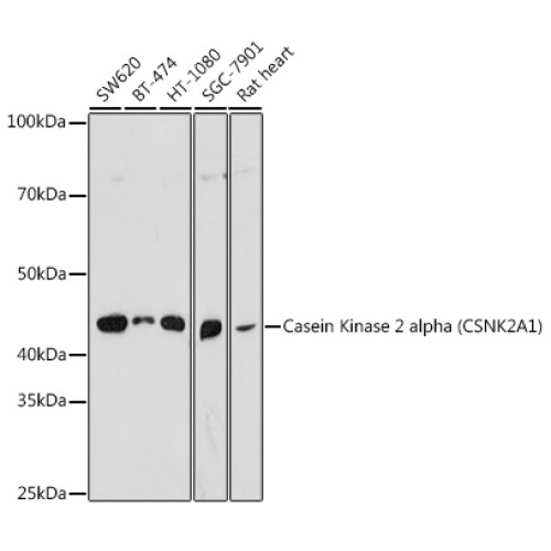 Casein Kinase 2 alpha (CSNK2A1) Rabbit pAb